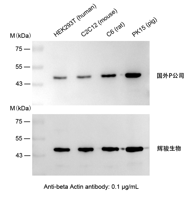 β-Actin小鼠单克隆抗体使用案例-抗体操作简单,快速制备Actin抗体-6686体育生物